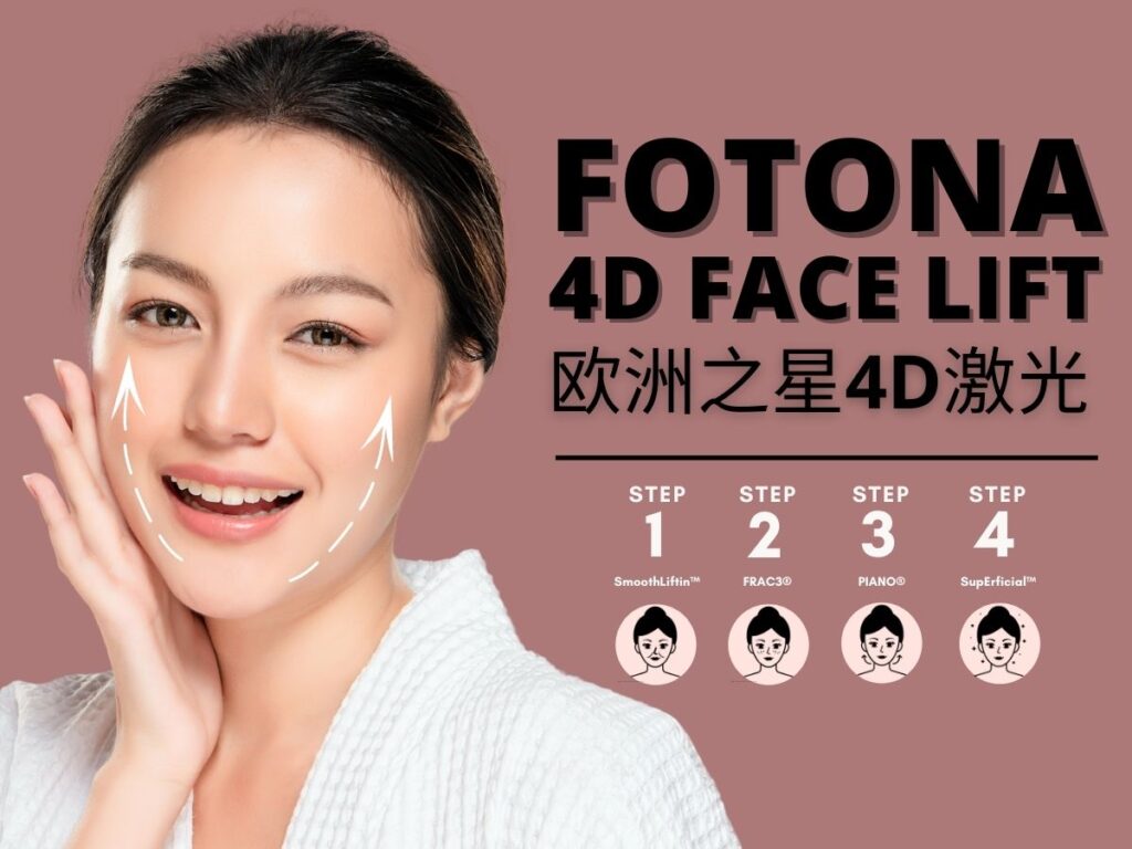 Complete Guide to Fotona Laser Face Lift 2023 in Singapore