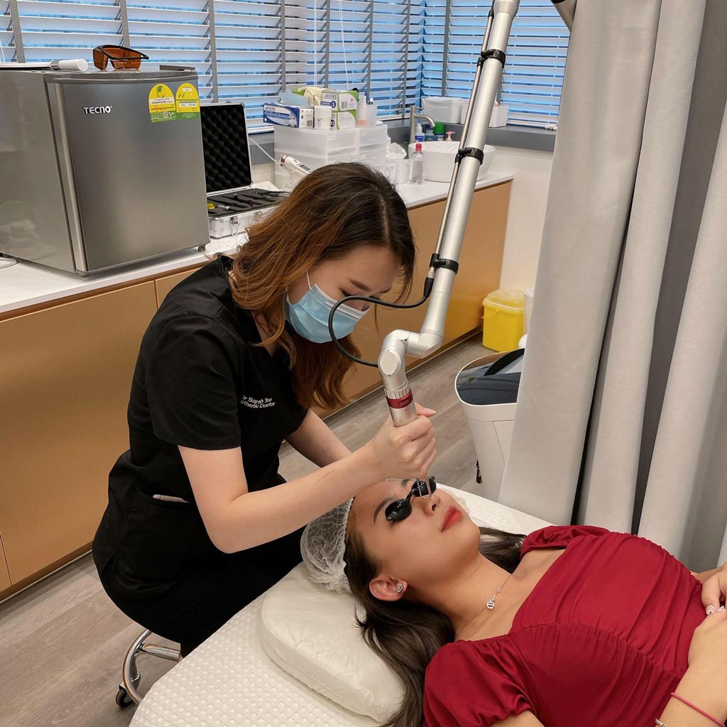 Doctor performing pico laser in Singapore