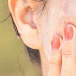 Pigmentation on skin