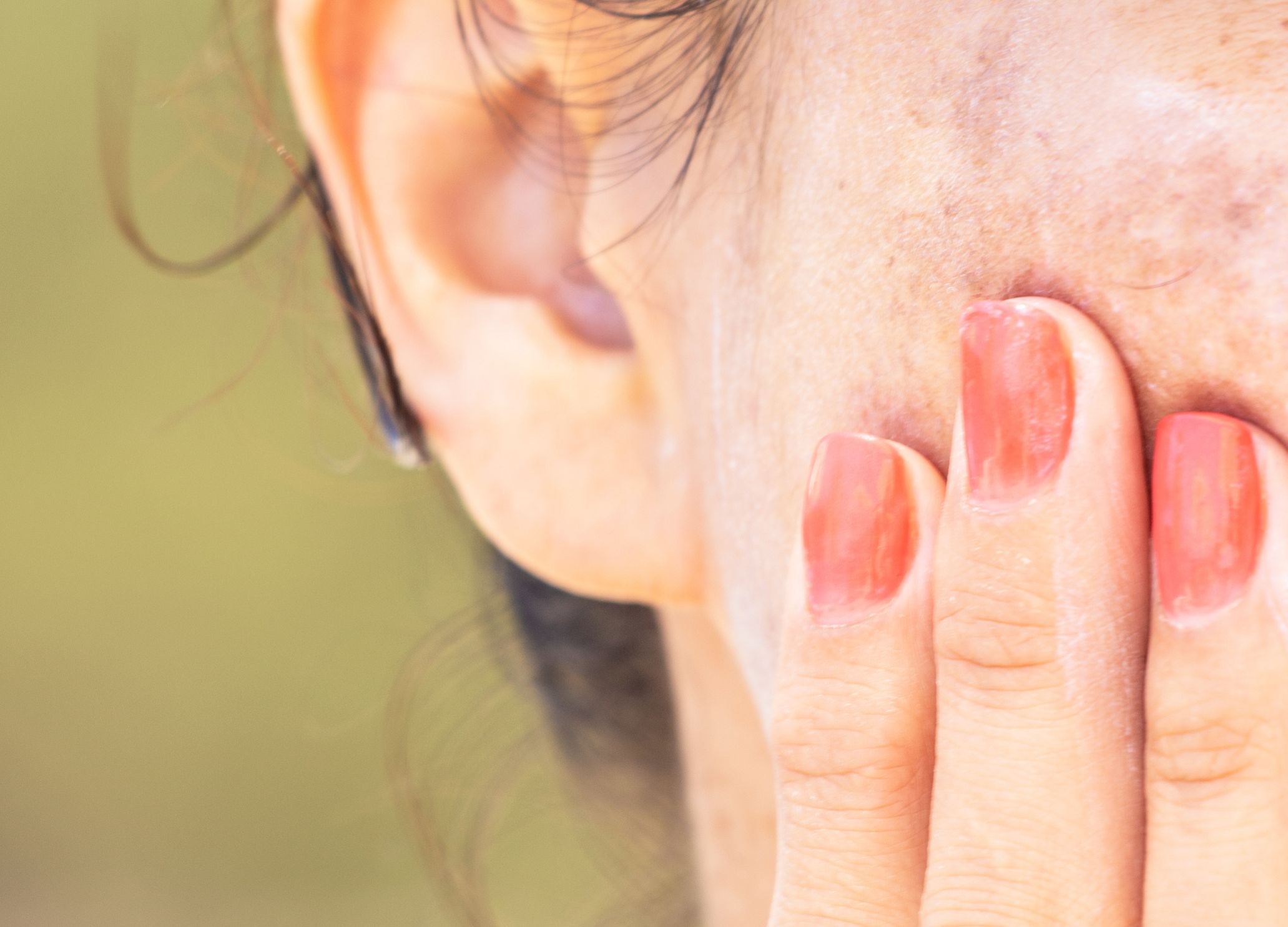 pigmentation on skin