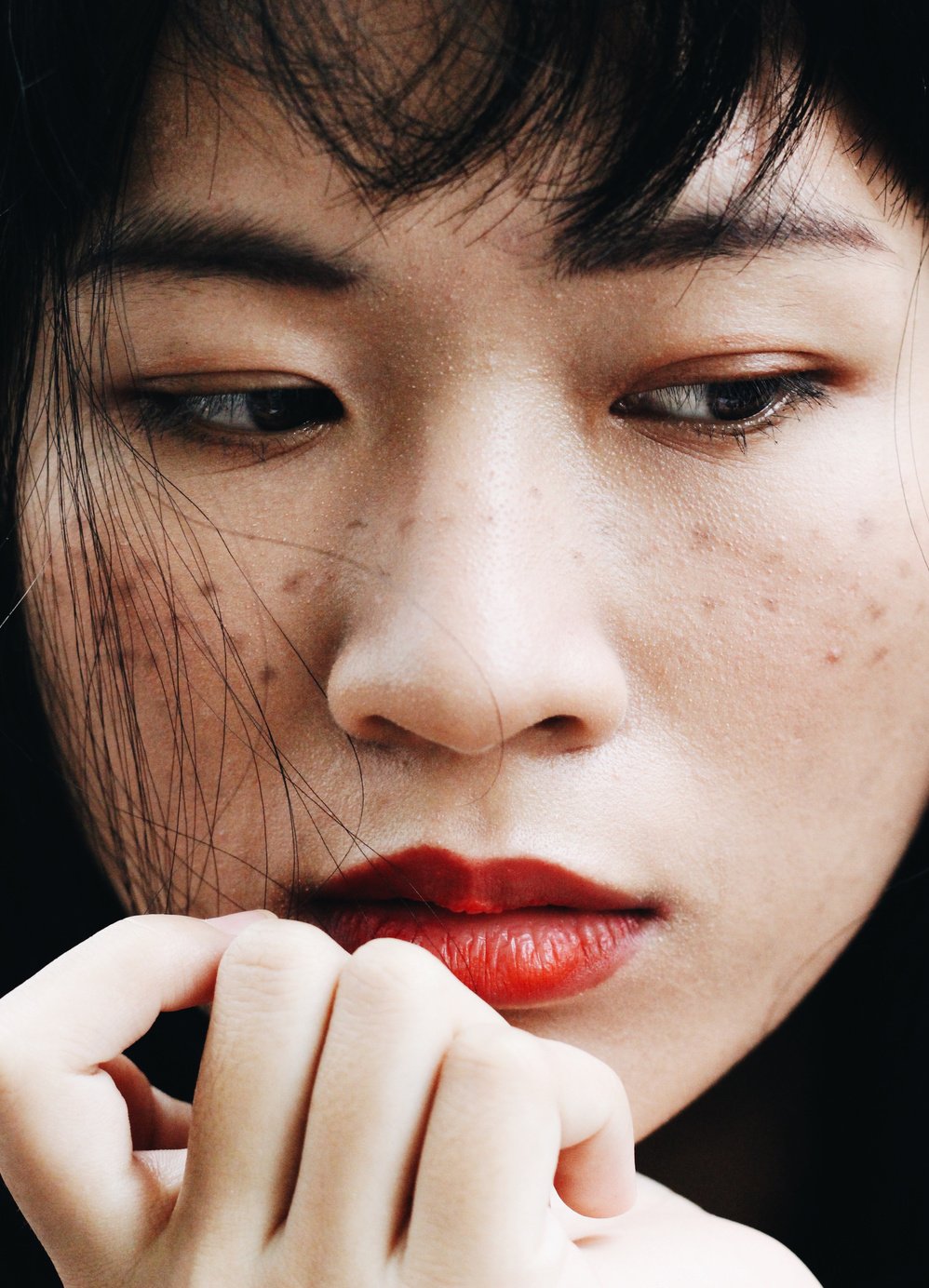 woman with pigmentation on skin
