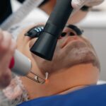 4 Ultimate Benefits To A Clear Skin With Carbon Laser Peel