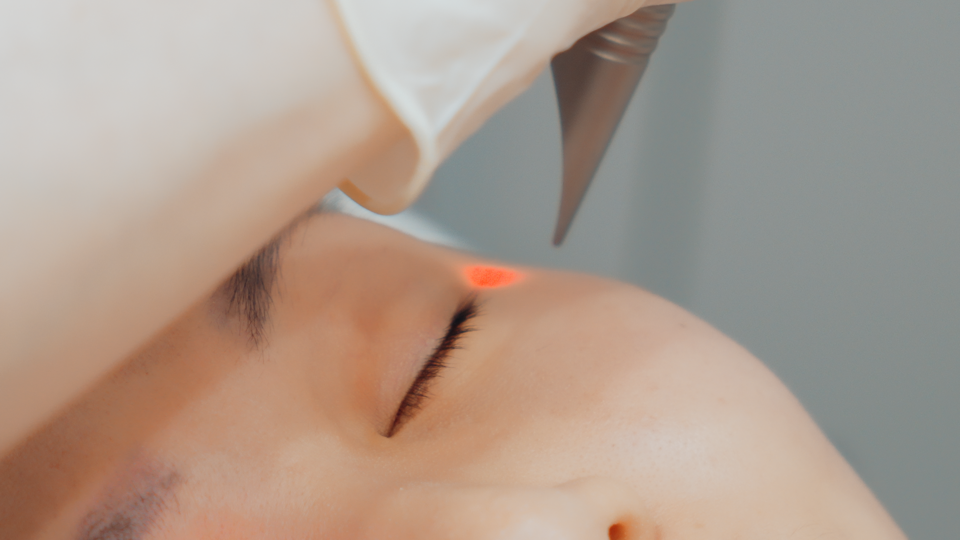 BAC_FOTONA-EYE_50