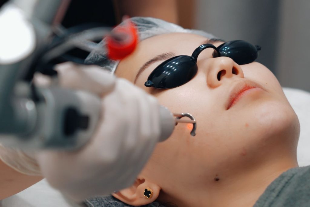 pico laser singapore