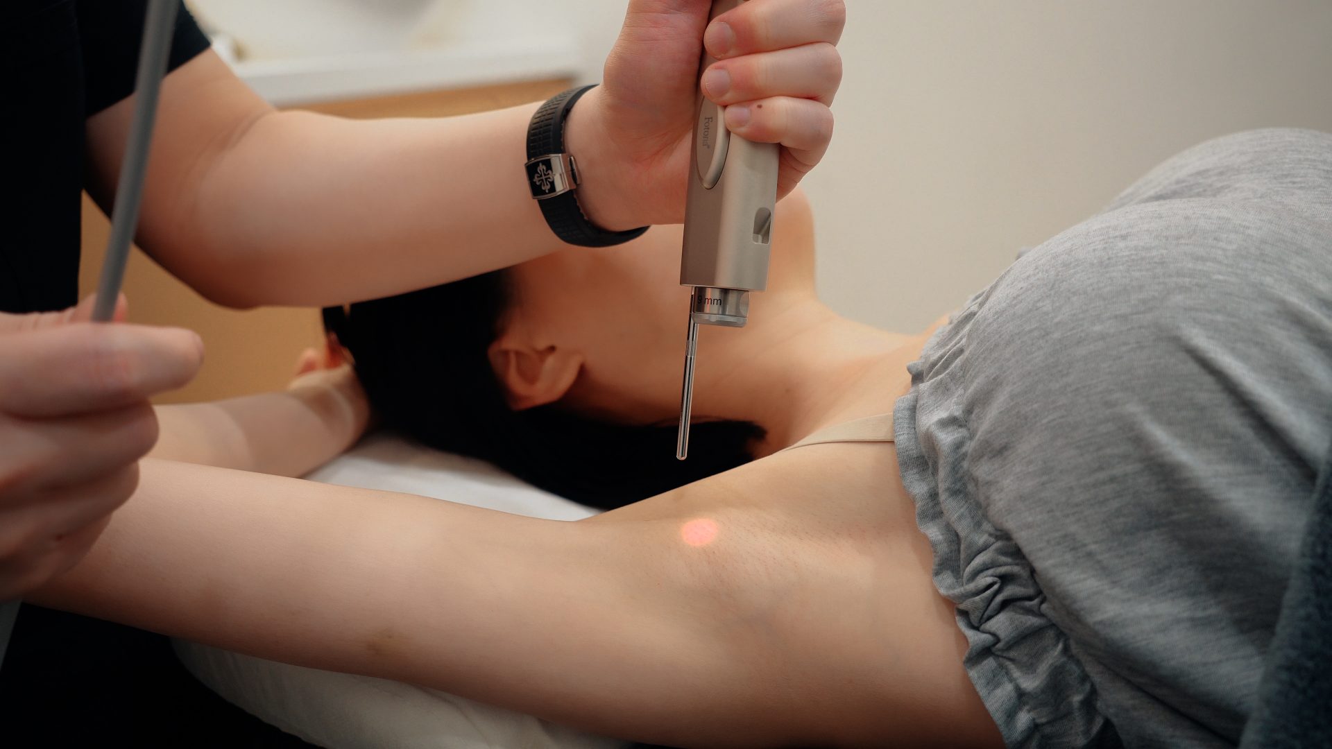 Laser Hair Removal