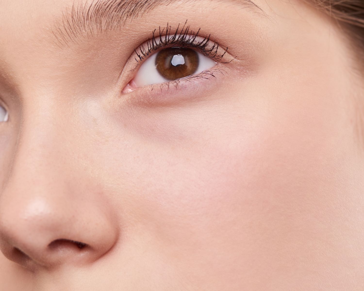 Acne-Laser-To-A-Flawless-Skin