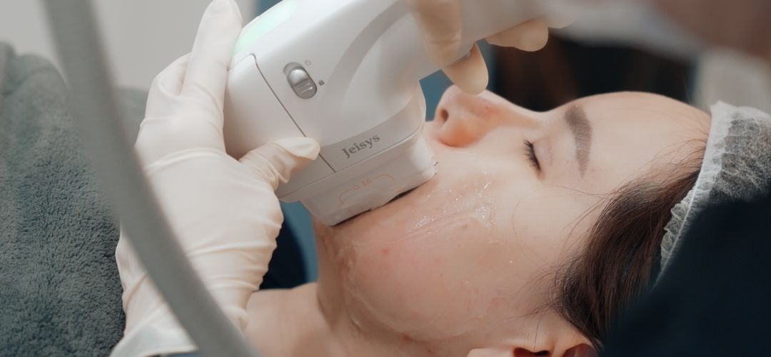 HIFU Treatment SIngapore