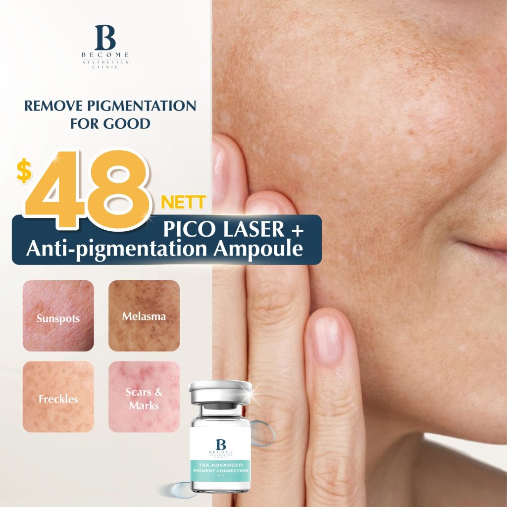 Pigmentation Pico Laser Treatment $48