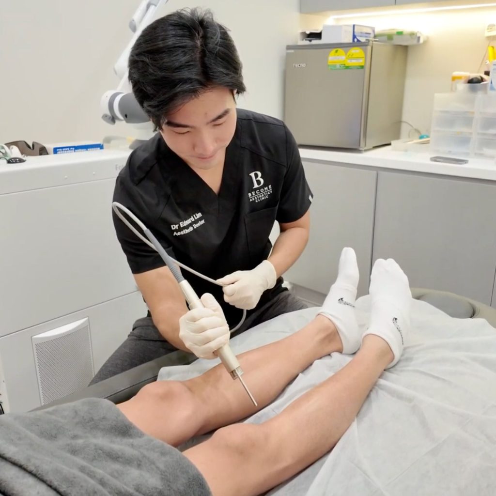 Laser Hair Removal Dr Edward