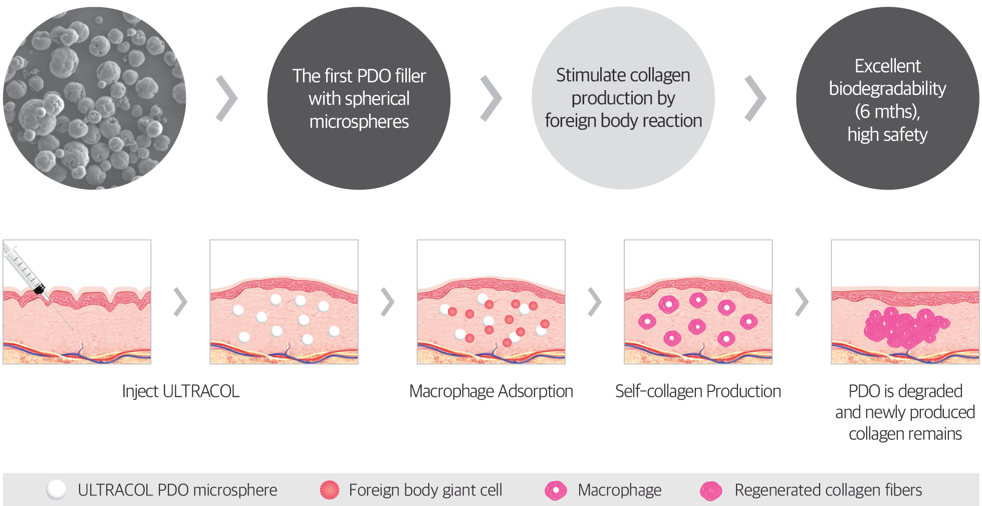 How does ultracol work