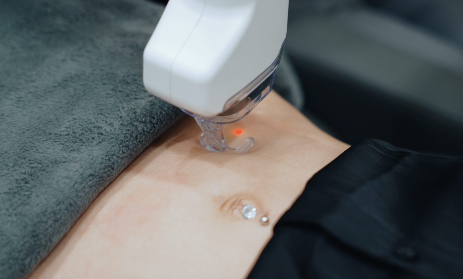 Co2 Fractional Laser