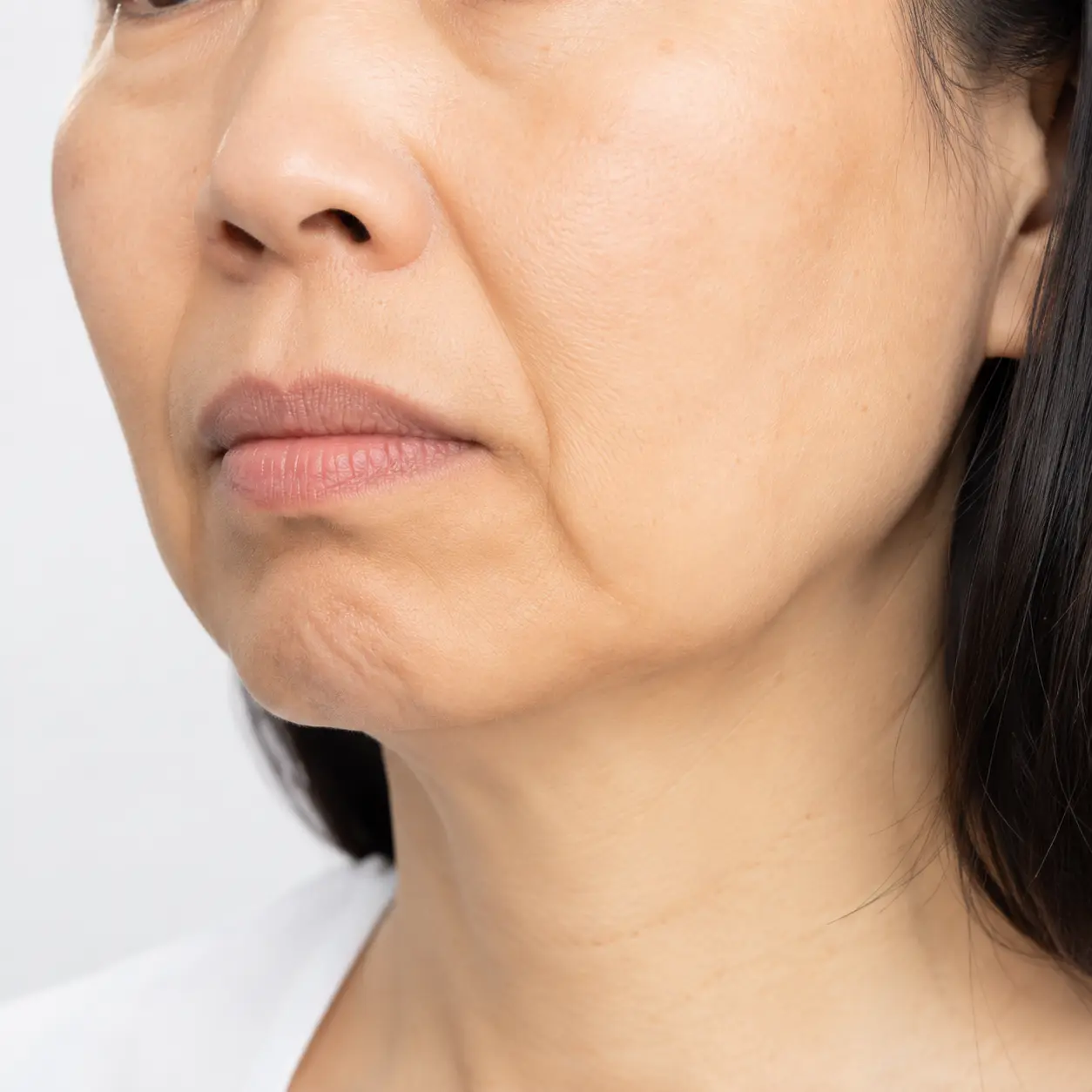 sculptra